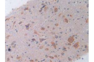 IHC-P analysis of Rat Spinal Cord Tissue, with DAB staining. (IL-4 anticorps  (AA 61-111))