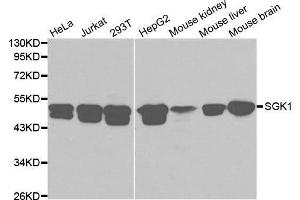 Western blot analysis of extracts of various cell lines, using SGK1 antibody. (SGK1 anticorps  (AA 172-431))