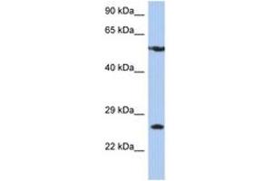 Image no. 1 for anti-Zinc Finger Protein 10 (ZNF10) (AA 107-156) antibody (ABIN6744401) (ZNF10 anticorps  (AA 107-156))