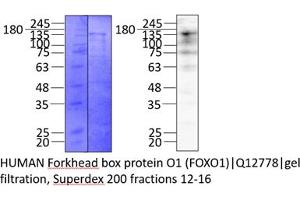 Western Blotting (WB) image for Forkhead Box O1 (FOXO1) (AA 1-655) protein (Strep Tag) (ABIN3092659) (FOXO1 Protein (AA 1-655) (Strep Tag))