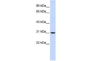 CYB5D2 antibody used at 1 ug/ml to detect target protein. (CYB5D2 anticorps  (N-Term))
