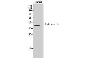 Western Blotting (WB) image for anti-Doublecortin (DCX) (Ser30) antibody (ABIN3184351) (Doublecortin anticorps  (Ser30))