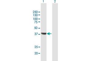 Western Blot analysis of RSAD2 expression in transfected 293T cell line by RSAD2 MaxPab polyclonal antibody. (RSAD2 anticorps  (AA 1-361))