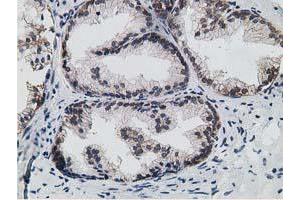 Immunohistochemical staining of paraffin-embedded Human prostate tissue using anti-HPGD mouse monoclonal antibody. (HPGD anticorps)