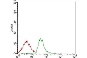 Immunohistochemical analysis of paraffin-embedded bladder cancer tissues using ALCAM antibody with DAB staining. (CD166 anticorps  (AA 48-216))