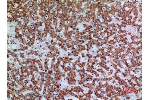 Immunohistochemistry (IHC) analysis of paraffin-embedded Human Liver, antibody was diluted at 1:100. (APAF1 anticorps  (Internal Region))