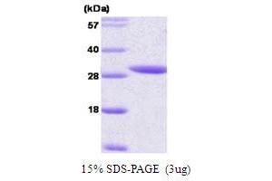 Figure annotation denotes ug of protein loaded and % gel used. (YWHAE Protein (AA 1-255))