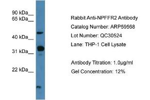 WB Suggested Anti-NPFFR2  Antibody Titration: 0. (NPFFR2 anticorps  (C-Term))