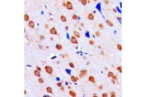 Immunohistochemical analysis of CHK1 (pS317) staining in human brain formalin fixed paraffin embedded tissue section. (CHEK1 anticorps  (pSer317))