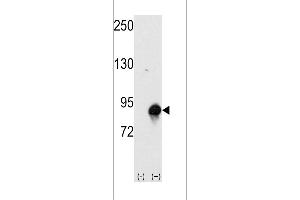 Western blot analysis of CUL4a using rabbit polyclonal CUL4a Antibody (Human N-term).