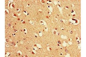 Immunohistochemistry of paraffin-embedded human brain tissue using ABIN7169128 at dilution of 1:100