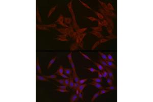 Immunofluorescence analysis of NIH/3T3 cells using NPHP1 Rabbit pAb (ABIN6128349, ABIN6144768, ABIN6144769 and ABIN6222377) at dilution of 1:50 (40x lens).