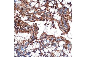 Immunohistochemistry of paraffin-embedded mouse colon using Galectin 4/LG Rabbit mAb (ABIN1679347, ABIN3017979, ABIN3017980 and ABIN7101554) at dilution of 1:100 (40x lens).