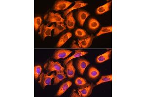 Immunofluorescence analysis of U20S cells using Rig-I/DDX58 antibody (ABIN6130263, ABIN6139513, ABIN6139515 and ABIN6217394) at dilution of 1:100. (DDX58 anticorps  (AA 726-925))