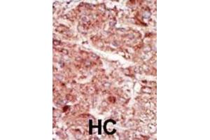 Immunohistochemistry (IHC) image for anti-Hexokinase 3 (White Cell) (HK3) antibody (ABIN3003707) (HK3 anticorps)