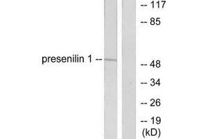Western Blotting (WB) image for anti-Presenilin 1 (PSEN1) (N-Term) antibody (ABIN1848748) (Presenilin 1 anticorps  (N-Term))