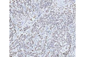 IHC analysis of MCM6 using anti-MCM6 antibody (ABIN7600037). (MCM6 anticorps  (AA 14-821))