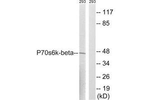 Western Blotting (WB) image for anti-Ribosomal Protein S6 Kinase, 70kDa, Polypeptide 2 (RPS6KB2) (Ser423) antibody (ABIN1848245) (RPS6KB2 anticorps  (Ser423))