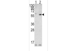 Western blot analysis of PTEN (arrow) using rabbit PTEN Antibody (N-term) (ABIN6242545 and ABIN6579042).
