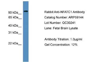 WB Suggested Anti-NFATC1  Antibody Titration: 0. (NFATC1 anticorps  (N-Term))