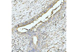 IHC analysis of HUPF2/RENT2/UPF2 using anti-HUPF2/RENT2/UPF2 antibody (ABIN7600567). (RENT2/UPF2 anticorps  (AA 200-651))