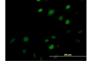 Immunofluorescence of monoclonal antibody to MAZ on HeLa cell. (MAZ anticorps  (AA 332-440))