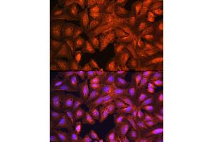 Immunofluorescence analysis of U-2 OS cells using L Rabbit pAb (ABIN1680664, ABIN3018314, ABIN3018315 and ABIN6220434) at dilution of 1:100 (40x lens).