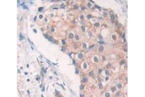 Used in DAB staining on fromalin fixed paraffin- embedded Kidney tissue (SRPK3 anticorps  (AA 247-517))