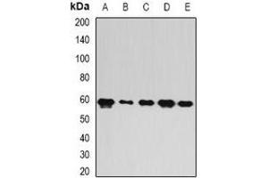 Western blot analysis of FIR expression in A549 (A), mouse brain (B), mouse spleen (C), rat lung (D), rat liver (E) whole cell lysates. (FARP2 anticorps)
