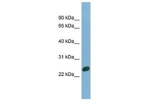 CHMP1B antibody used at 1 ug/ml to detect target protein. (CHMP1B anticorps  (N-Term))