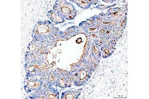 IHC analysis of MUC13 using anti-MUC13 antibody (ABIN6719597). (MUC13 anticorps  (AA 226-312))