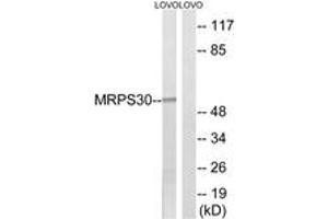 Western blot analysis of extracts from LOVO cells, using MRPS30 Antibody. (MRPS30 anticorps  (AA 390-439))