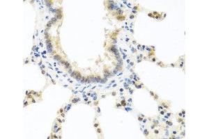 Immunohistochemistry of paraffin-embedded Rat lung using DEDD Polyclonal Antibody at dilution of 1:100 (40x lens). (DEDD anticorps)