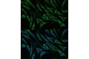 Immunofluorescence analysis of L929 cells using VARS Polyclonal Antibody (ABIN1683239, ABIN3018665, ABIN3018666 and ABIN6220533) at dilution of 1:100 (40x lens). (VARS anticorps  (AA 1-280))