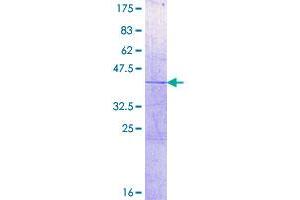 Image no. 1 for Histone H2A Type 1-C (HIST1H2AC) (AA 1-130) protein (GST tag) (ABIN1306665)