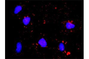 Proximity Ligation Analysis of protein-protein interactions between CDK7 and E2F1.