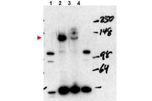 Image no. 1 for anti-Nuclear Receptor Coactivator 3 (NCOA3) (Internal Region), (Isoform A) antibody (ABIN401408) (NCOA3 anticorps  (Internal Region, Isoform A))