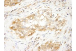 Immunohistochemistry (IHC) image for anti-Tripartite Motif Containing 3 (TRIM3) (AA 1-50) antibody (ABIN7448842) (TRIM3 anticorps  (AA 1-50))