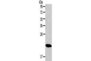 Western Blotting (WB) image for anti-RAB18, Member RAS Oncogene Family (RAB18) antibody (ABIN2430977) (RAB18 anticorps)