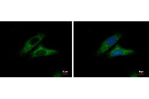 ICC/IF Image Alpha-catulin antibody [N3C2], Internal detects Alpha-catulin protein at cytoplasm by immunofluorescent analysis. (CTNNAL1 anticorps  (Internal Region))