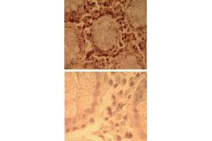 Immunohistochemical analysis of human colon tissue using TLR7 polyclonal antibody  (top) and an isotype control (bottom) at 5 ug/mL . (TLR7 anticorps  (AA 706-728))