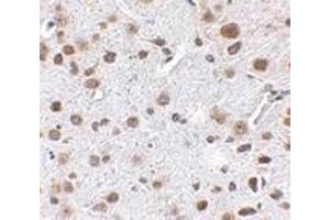 Immunohistochemistry of FTO in mouse brain tissue with FTO antibody at 2. (FTO anticorps  (N-Term))
