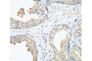 Immunohistochemistry of paraffin-embedded Human prostate using CBL Polyclonal Antibody at dilution of 1:200 (40x lens). (CBL anticorps)