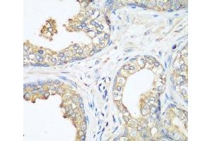 Immunohistochemistry of paraffin-embedded Human prostate using CBL Polyclonal Antibody at dilution of 1:200 (40x lens).