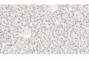 Detection of LSR in Human Liver Tissue using Monoclonal Antibody to Lipolysis Stimulated Lipoprotein Receptor (LSR)