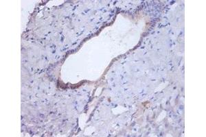 Immunohistochemistry of paraffin-embedded human liver tissue using ABIN7146996 at dilution of 1:100 (Cathepsin B anticorps  (AA 82-333))
