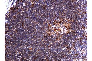 Image no. 1 for anti-Pogo Transposable Element with KRAB Domain (POGK) antibody (ABIN1500329)