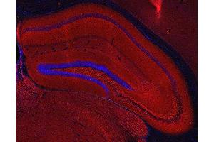 Indirect immunostaining of PFA fixed mouse hippocampus section (dilution 1 : 200; red).