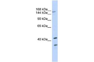 WB Suggested Anti-ABCC8 Antibody Titration:  0. (ABCC8 anticorps  (N-Term))
