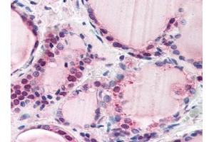 Image no. 1 for anti-F-Box and Leucine-Rich Repeat Protein 3 (FBXL3) (N-Term) antibody (ABIN372963) (FBXL3 anticorps  (N-Term))